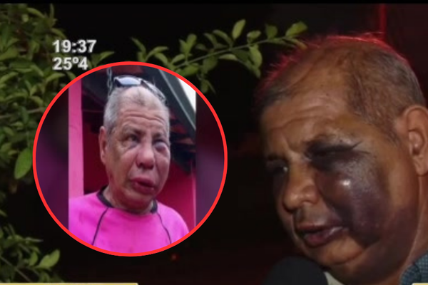 Brutal agresión a un adulto mayor en Villa Elisa - SNT