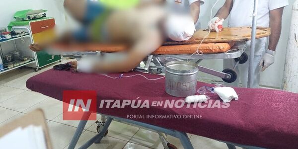 HOMBRE RECIBIÓ UN DISPARO EN EL OJO POR SU PROPIA ARMA