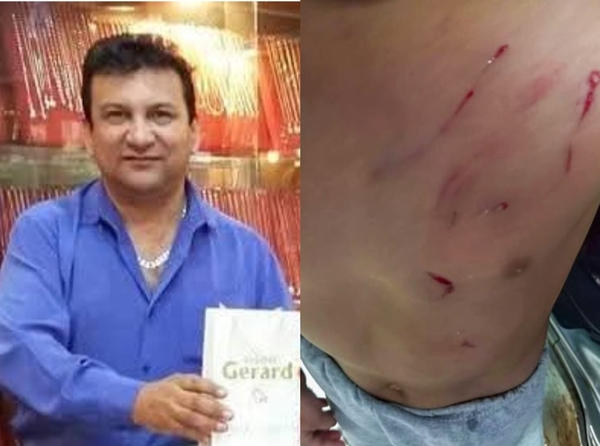 Gerardo Melgarejo menazó de muerte a un hombre luego de que su perro atacó a un niño - Noticiero Paraguay