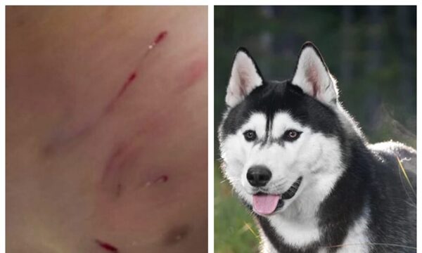 Perro atacó a niño de 8 años y dueño amenazó de muerte a su padre