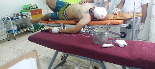 Hombre resulta herido por disparo accidental de arma de fuego en su local comercial