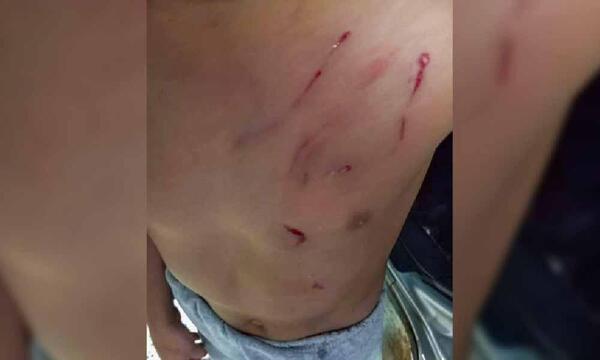 Coronel Oviedo: Perro atacó a un niño y dueño amenazó de muerte al padre del menor – Prensa 5