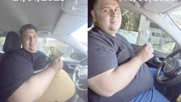 Bajó 33 kilos tras bypass gástrico