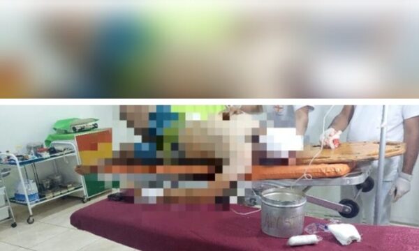 Hombre resbaló, se cayó y se disparó en el ojo