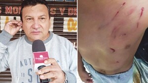 Perro mordió a un niño y el dueño amenazó con escopeta