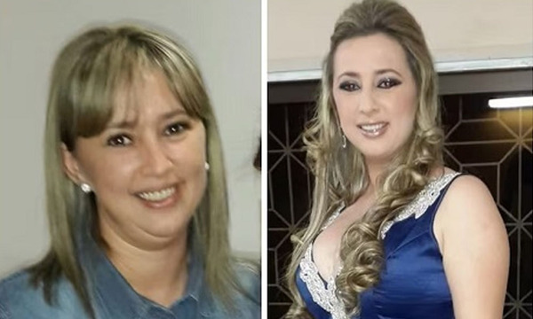 Cirugías estéticas con fondos públicos: Ex intendenta de Tava'i en juicio oral - OviedoPress