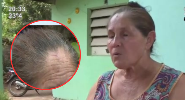 Pidió a su vecina que deje de quemar basura y terminó agredida - SNT