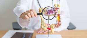 Cáncer colorrectal: cuatro mitos sobre la enfermedad, una de las más frecuentes en Paraguay - Nacionales - ABC Color