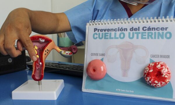 El cáncer de cuello uterino es prevenible y acá te contámos algunas claves