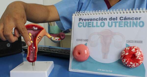 La Nación / Cáncer de cuello uterino es curable en el 95 % de los casos si se detecta a tiempo