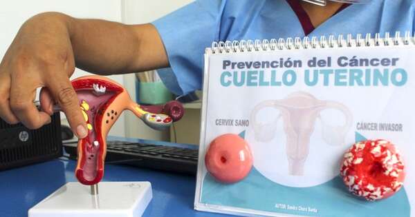 La Nación / Cáncer de cuello uterino: detección puede salvar