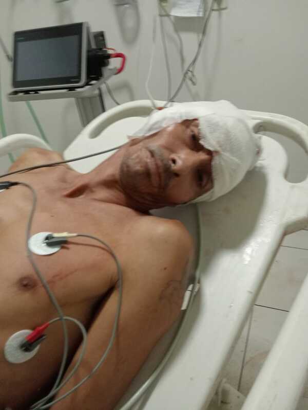Hombre quedó herido con arma blanca en el barrio Chaipé de Encarnación