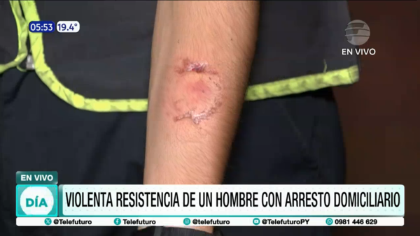 Violenta resistencia de un hombre con arresto domiciliario en J. Augusto Saldívar