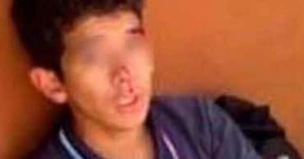Diario HOY | Delincuente garrotea a estudiante durante intento de robo de celular