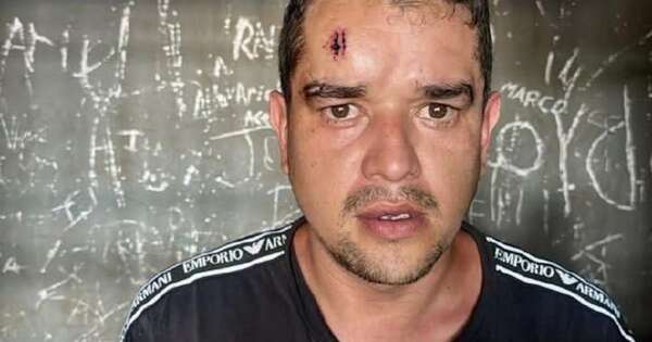 Diario HOY | Policía con prisión domiciliaria sufre quemaduras tras provocar incendio en su pieza