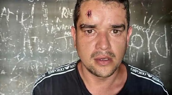 Policía con prisión domiciliaria sufre quemaduras tras provocar incendio en su pieza