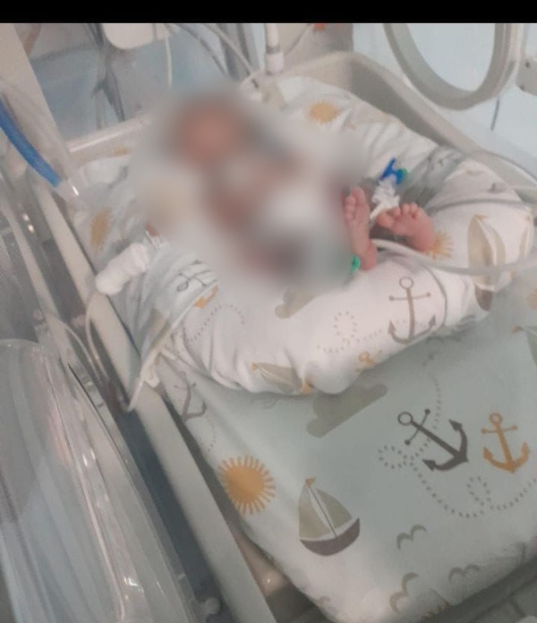 Bebé prematuro necesita ayuda de forma urgente