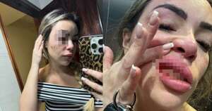 Diario HOY | Mujer fue víctima de brutal golpiza: caso salpica a ejecutivo