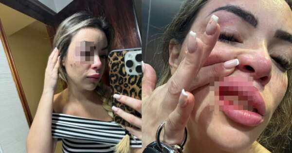 Diario HOY | Mujer fue víctima de brutal golpiza: caso salpica a ejecutivo