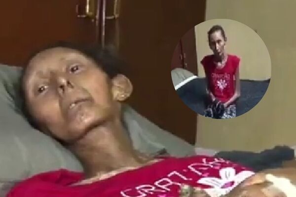 Alicia necesita ayuda en su lucha contra la esclerodermia - SNT