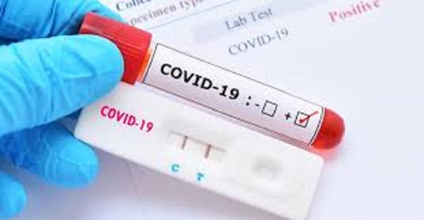 Confirman aumento del 73% de los casos de covid-19