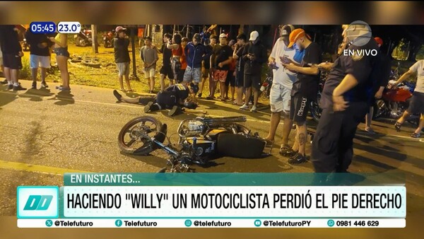 Capiatá: Perdió uno de los pies haciendo ''Willy''