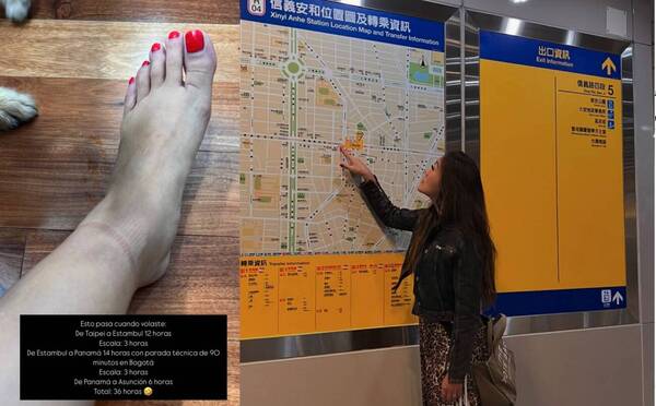 ¡Qué mala pata! Mirá como le quedaron los pies a Yolanda Park por no parar durante ¡36 horas!