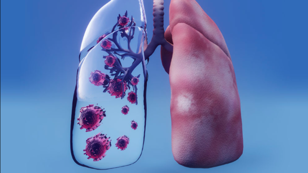 Tuberculosis en Paraguay: Mayor número de casos se dan en cárceles y poblaciones indígenas