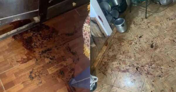 Diario HOY | Hombre despertó sin testículos y sin recordar nada: lo que descubrió la Fiscalía