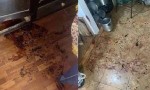 Hombre despertó sin testículos y sin recordar nada: lo que descubrió la Fiscalía – Prensa 5