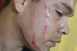 Borracho no quiso bajar volumen de música y atacó a policías