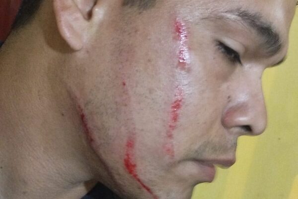 Borracho no quiso bajar volumen de música y atacó a policías