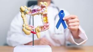 Médicos lamentan sobre detección tardía de cáncer colorrectal en el Paraguay