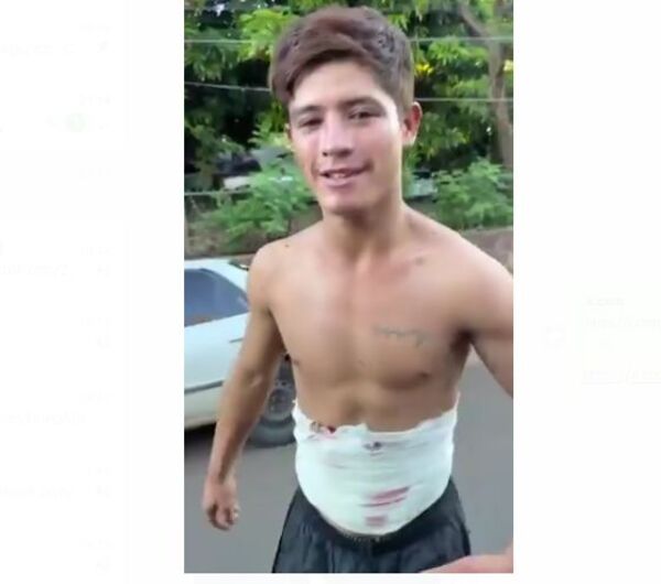 (VIDEO). Joven baleado por seguridá: “Gracias a Dios estoy mejor”