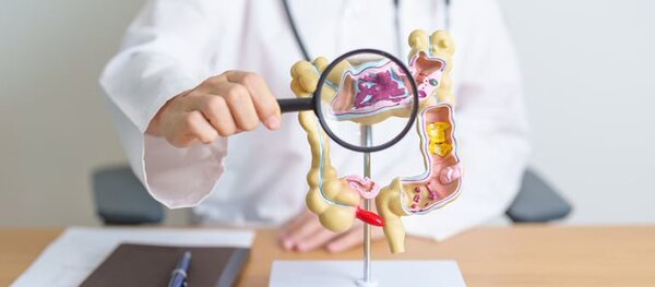 Médicos hablan sobre detección tardía de cáncer colorrectal en nuestro terruño