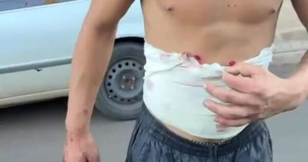 Diario HOY | Guardia de seguridad dispara balines de goma a joven