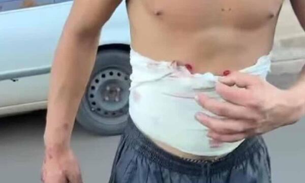 Guardia de seguridad dispara balines de goma a joven – Prensa 5