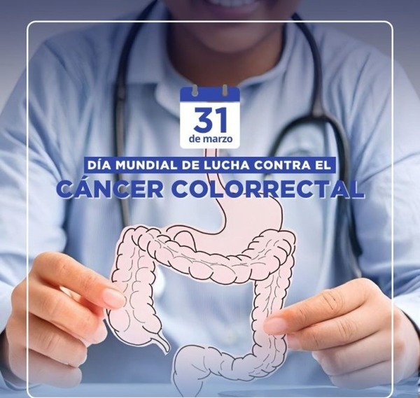 Día Mundial de Lucha Contra el Cáncer de Colon: prevención es clave en detección temprana - ADN Digital