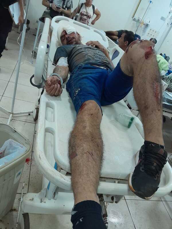 Hurtó una motocicleta y se accidentó