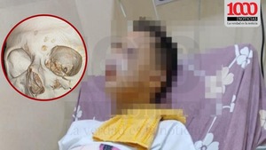 Investigan denuncia de brutal agresión contra menor de 12 años que fue hospitalizado - 1000 Noticias