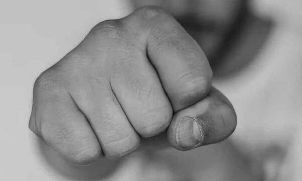 Brutal agresión en colegio: niño sufrió grave fractura – Prensa 5