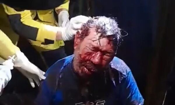 Golpean a indigente en CDE
