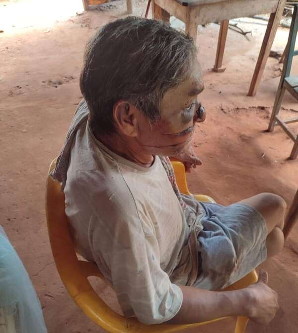 Guayaybí: colono acusado de presunto robo de gallinas fue brutalmente golpeado por su vecino - Nacionales - ABC Color