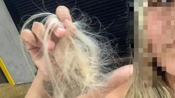 Le arrancó los pelos: “No fue por un hombre, fue por envidia”, dijo la víctima