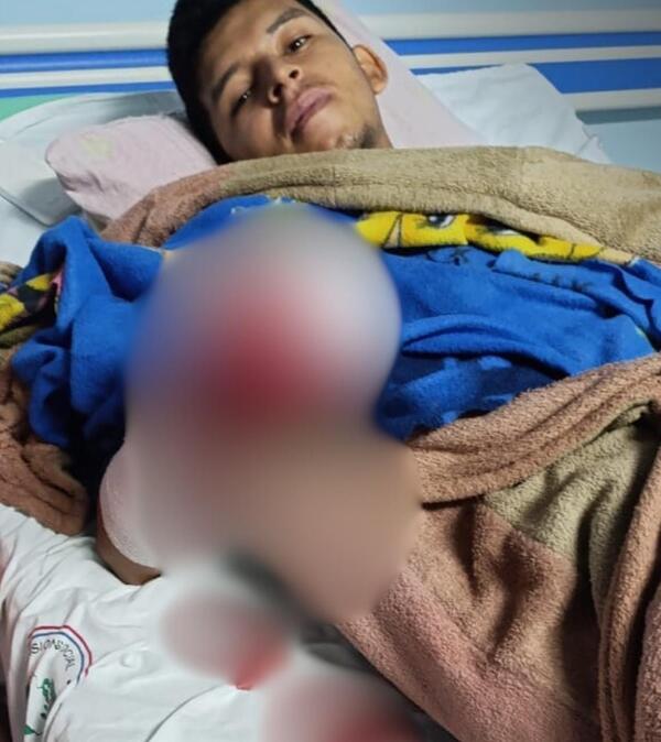 Accidente laboral deja sin mano a joven y exige indemnización - Portal Digital Cáritas Universidad Católica