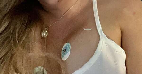 La Nación / Mujer que acusó al príncipe Andrés resultó herida en grave accidente