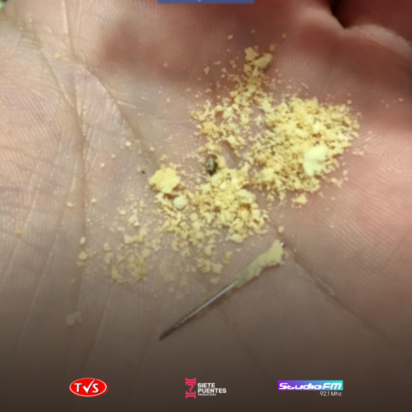 Niño de 7 años casi traga una aguja en chipita del programa "Hambre Cero" en Itapúa - TVS