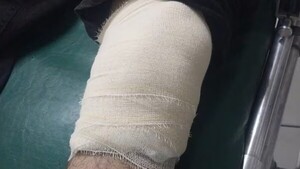 Balearon a conductor de Moto Bolt y pasajero en asalto