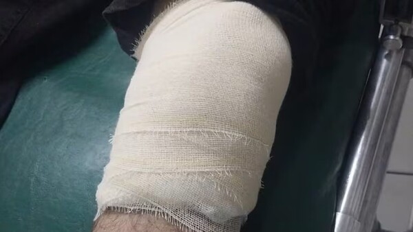 Balearon a conductor de Moto Bolt y pasajero en asalto