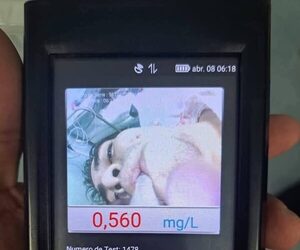¡Imprudencia!: Tatachitos impactaron contra camión recolector